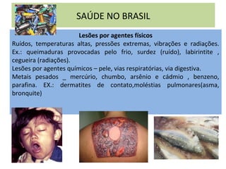 SAÚDE NO BRASIL
Lesões por agentes físicos
Ruídos, temperaturas altas, pressões extremas, vibrações e radiações.
Ex.: queimaduras provocadas pelo frio, surdez (ruído), labirintite ,
cegueira (radiações).
Lesões por agentes químicos – pele, vias respiratórias, via digestiva.
Metais pesados _ mercúrio, chumbo, arsênio e cádmio , benzeno,
parafina. EX.: dermatites de contato,moléstias pulmonares(asma,
bronquite)
 