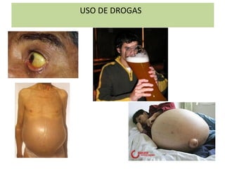 USO DE DROGAS
 