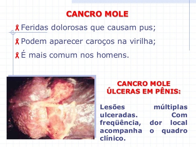 Remédio de gente para aumentar o tamanho do membro