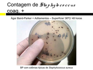 Contagem de Sta p hy lo c o c c us
coag. +
 Ágar Baird-Parker + Aditamentos – Superfície/ 36ºC/ 48 horas




        BP com colônias típicas de Staphylococcus aureus
 