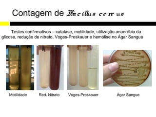 Contagem de Ba c illus c e re us

     Testes confirmativos – catalase, motilidade, utilização anaeróbia da
glicose, redução de nitrato, Voges-Proskauer e hemólise no Ágar Sangue




   Motilidade      Red. Nitrato   Voges-Proskauer          Ágar Sangue
 