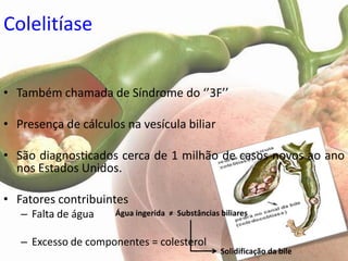 Colelitíase


• Também chamada de Síndrome do ‘’3F’’

• Presença de cálculos na vesícula biliar

• São diagnosticados cerca de 1 milhão de casos novos ao ano
  nos Estados Unidos.

• Fatores contribuintes
   – Falta de água   Água ingerida ≠ Substâncias biliares


   – Excesso de componentes = colesterol
                                                 Solidificação da bile
 