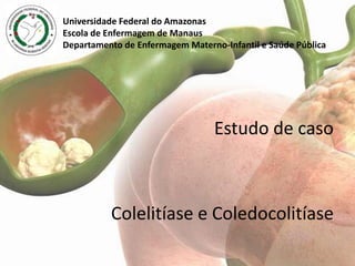 Universidade Federal do Amazonas
Escola de Enfermagem de Manaus
Departamento de Enfermagem Materno-Infantil e Saúde Pública




                                 Estudo de caso



          Colelitíase e Coledocolitíase
 