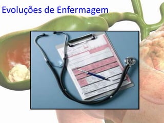 Evoluções de Enfermagem
 