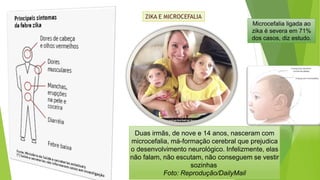 ZIKA E MICROCEFALIA
Duas irmãs, de nove e 14 anos, nasceram com
microcefalia, má-formação cerebral que prejudica
o desenvolvimento neurológico. Infelizmente, elas
não falam, não escutam, não conseguem se vestir
sozinhas
Foto: Reprodução/DailyMail
Microcefalia ligada ao
zika é severa em 71%
dos casos, diz estudo.
 