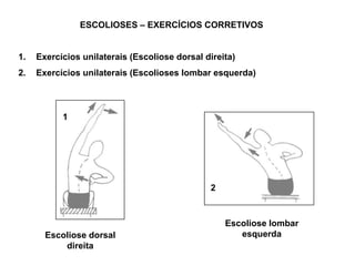 ESCOLIOSES – EXERCÍCIOS CORRETIVOS<br />Exercícios unilaterais (Escoliose dorsal direita)<br />Exercícios unilaterais (Esc...
