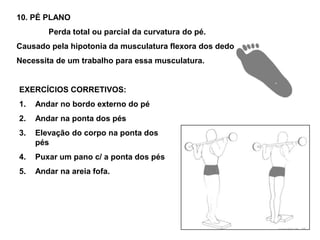 10. PÉ PLANO <br />	Perda total ou parcial da curvatura do pé.<br />Causado pela hipotonia da musculatura flexora dos dedo...