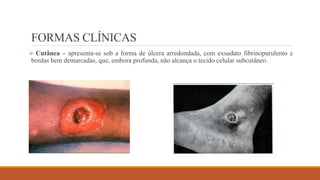 FORMAS CLÍNICAS
 Cutânea – apresenta-se sob a forma de úlcera arredondada, com exsudato fibrinopurulento e
bordas bem demarcadas, que, embora profunda, não alcança o tecido celular subcutâneo.
 