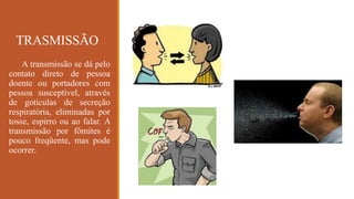 TRASMISSÃO
A transmissão se dá pelo
contato direto de pessoa
doente ou portadores com
pessoa susceptível, através
de gotículas de secreção
respiratória, eliminadas por
tosse, espirro ou ao falar. A
transmissão por fômites é
pouco freqüente, mas pode
ocorrer.
 