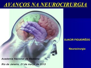 AVANÇOS NA NEUROCIRURGIA




                                      DJACIR FIGUEIRÊDO


                                         Neurocirurgia


Academia Nacional de Medicina

Rio de Janeiro, 21 de março de 2013
 