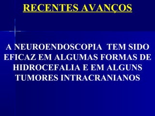 RECENTES AVANÇOS


A NEUROENDOSCOPIA TEM SIDO
EFICAZ EM ALGUMAS FORMAS DE
  HIDROCEFALIA E EM ALGUNS
  TUMORES INTRACRANIANOS
 