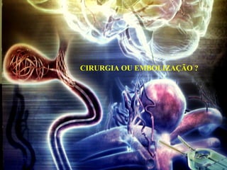 CIRURGIA OU EMBOLIZAÇÃO ?
 