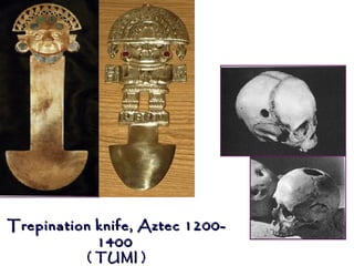 Trepination knife, Aztec 1200-
            1400
          ( TUMI )
 