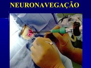 NEURONAVEGAÇÃO
 