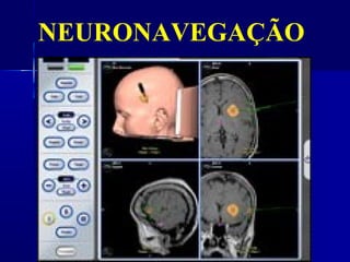 NEURONAVEGAÇÃO
 