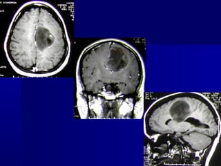 Dr. Djacir Figueirêdo "Evolução da neurocirurgia."