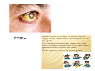 ICTERÍCIA
 