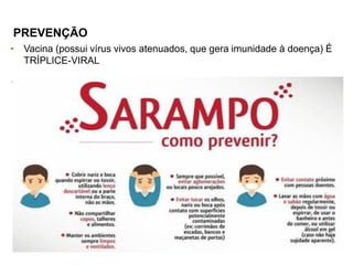 • Vacina (possui vírus vivos atenuados, que gera imunidade à doença) É
TRÍPLICE-VIRAL
.
PREVENÇÃO
 