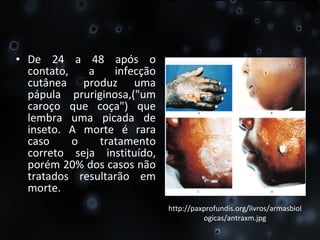 De 24 a 48 após o contato, a infecção cutânea produz uma pápula pruriginosa,("um caroço que coça") que lembra uma picada de inseto. A morte é rara caso o tratamento correto seja instituído, porém 20% dos casos não tratados resultarão em morte. http://paxprofundis.org/livros/armasbiologicas/antraxm.jpg 