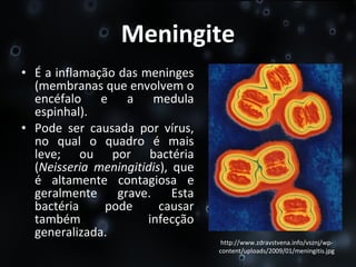 Meningite É a inflamação das meninges (membranas que envolvem o encéfalo e a medula espinhal). Pode ser causada por vírus, no qual o quadro é mais leve; ou por bactéria ( Neisseria meningitidis ), que é altamente contagiosa e geralmente grave. Esta bactéria pode causar também infecção generalizada.  http://www.zdravstvena.info/vsznj/wp-content/uploads/2009/01/meningitis.jpg 