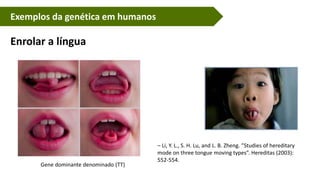 Exemplos da genética em humanos
– Li, Y. L., S. H. Lu, and L. B. Zheng. ”Studies of hereditary
mode on three tongue moving types”. Hereditas (2003):
552-554.
Enrolar a língua
Gene dominante denominado (TT)
 