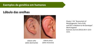 Exemplos da genética em humanos
Lóbulo das orelhas
Onyije, F. M. ”Assessment of
Morphogenetic Trait of AEL
and CRT in Relation to Hb Genotype”.
World Applied
Sciences Journal (2012) 20.9: 1213-
1215.
Lóbulo solto
(alelo dominante)
Lóbulo preso
(alelo recessivo)
 