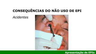 Apresentação de EPIs
Acidentes
CONSEQUÊNCIAS DO NÃO USO DE EPI
 