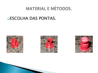  ESCOLHA   DAS PONTAS.
 