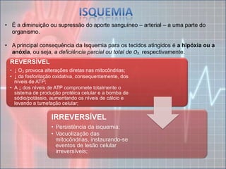 isquemia e infarto | PPTX