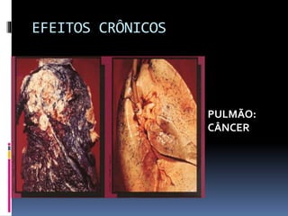 EFEITOS CRÔNICOS
PULMÃO:
CÂNCER
 