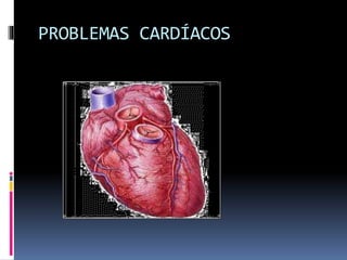 PROBLEMAS CARDÍACOS
 