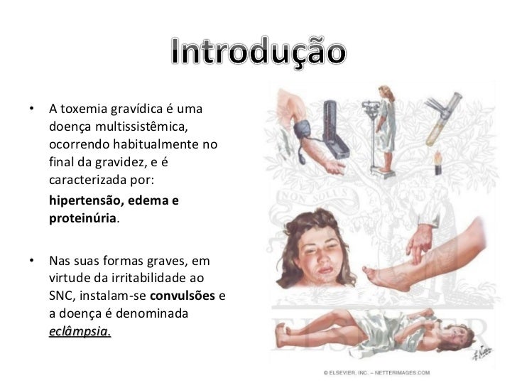 Apresentação eclampsia