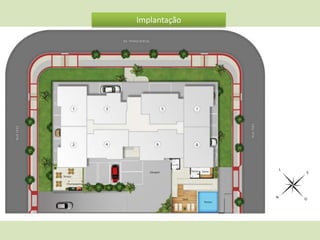 Implantação

 