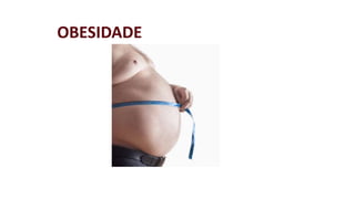 OBESIDADE 
 