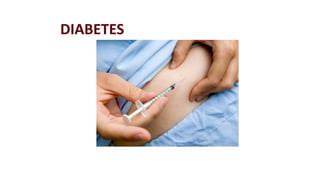 DIABETES 
 