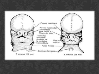 Formação do lábio superior		As proeminênciasnasaislateraisnãoformamparte do lábio superior, constituem os lados do nariz. Quando as prominencias nasaismediaisse mesclam, formam um  segmento intermaxilar  compostode trêspartes: Um componente labial  que forma ofiltro do lábiosuperior Um componente maxilar que terárelaçãocom os quatodentesincisivosUm componente palatino  que se transforma em paladar primário