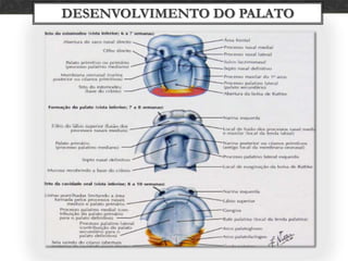 DESENVOLVIMENTO                   DO PALATO PROCESSO PALATINOMEDIANO    (PALATO PRIMÁRIO)PORÇÃO ANTERIORPROCESSOS PALATINOS LATERAIS(PALATO SECUNDÁRIO) PORÇÃO POSTERIOR MAIS EXTENSA