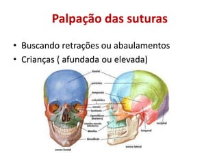 Palpação das suturas
• Buscando retrações ou abaulamentos
• Crianças ( afundada ou elevada)
 