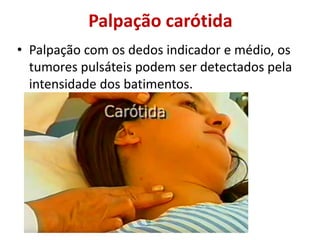 Palpação carótida
• Palpação com os dedos indicador e médio, os
tumores pulsáteis podem ser detectados pela
intensidade dos batimentos.
 