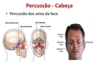 Percussão - Cabeça
• Percussão dos seios da face.
 