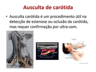 Ausculta de carótida
• Ausculta carótida é um procedimento útil na
detecção de estenose ou oclusão da carótida,
mas requer confirmação por ultra-som.
 