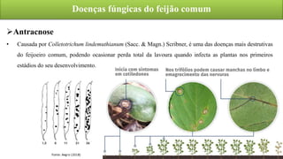 Doenças fúngicas do feijão comum
Antracnose
• Causada por Colletotrichum lindemuthianum (Sacc. & Magn.) Scribner, é uma das doenças mais destrutivas
do feijoeiro comum, podendo ocasionar perda total da lavoura quando infecta as plantas nos primeiros
estádios do seu desenvolvimento.
 