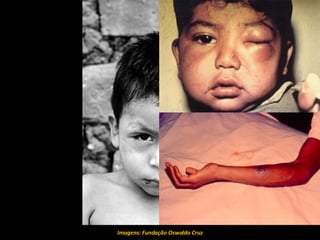 Imagens: Fundação Oswaldo Cruz 