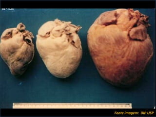 Fonte imagem:  DIP USP  