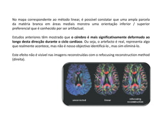 No mapa correspondente ao método linear, é possível constatar que uma ampla parcela
da matéria branca em áreas mediais monstra uma orientação inferior / superior
preferencial que é conhecido por ser artifactual.

Estudos anteriores têm mostrado que o cérebro é mais significativamente deformado ao
longo desta direcção durante o ciclo cardíaco. Ou seja, o artefacto é real, representa algo
que realmente acontece, mas não é nosso objectivo identificá-lo , mas sim eliminá-lo.

Este efeito não é visível nas imagens reconstruídas com o refocusing reconstruction method
(direita).
 
