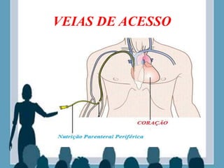 VEIAS DE ACESSO
 
