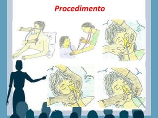 Procedimento
 