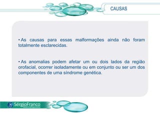CAUSAS
• As causas para essas malformações ainda não foram
totalmente esclarecidas.
• As anomalias podem afetar um ou dois lados da região
orofacial, ocorrer isoladamente ou em conjunto ou ser um dos
componentes de uma síndrome genética.
 