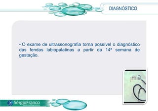 DIAGNÓSTICO
• O exame de ultrassonografia torna possível o diagnóstico
das fendas labiopalatinas a partir da 14ª semana de
gestação.
 