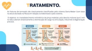 TRATAMENTO.
As fraturas de tornozelo são classicamente classificadas pelo sistema Danis-Weber (com base
na altura da lesão na fíbula em relação à sindesmose) e pelo sistema.
O objetivo é o restabelecimento milimétrico da pinça maleolar, pois desvios maiores que 1 mm
no tálus alteram drasticamente a distribuição de carga na articulação, induzindo à degeneração
precoce.
 